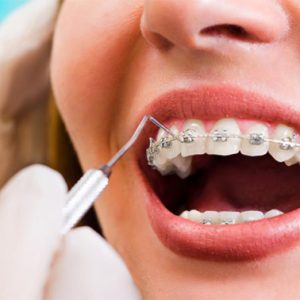 orthodontics-prime-dental-hospital-kushinagar